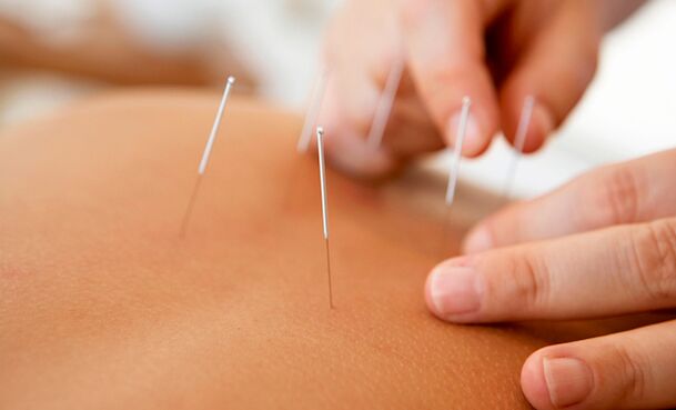potensialı artırmaq üçün akupunktur